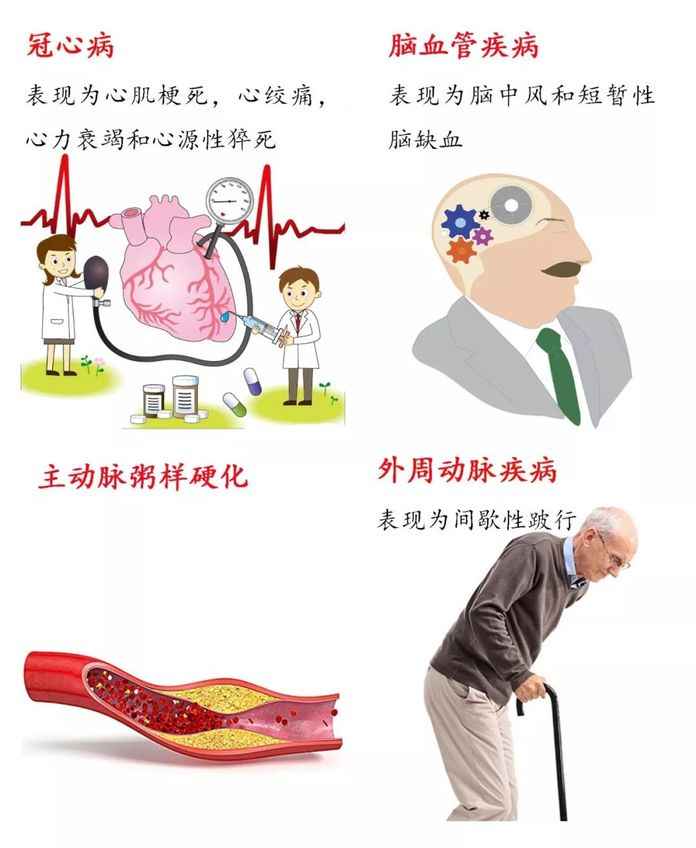 心血管疾病包括以下4大類疾病