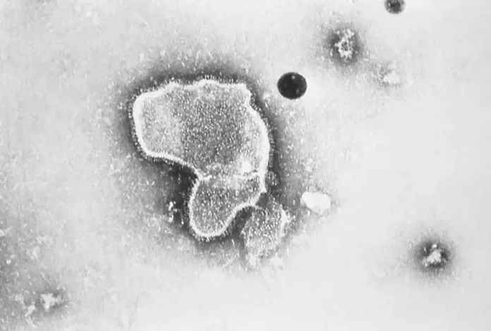 顯微鏡下的RSV病毒（圖源：AP）
