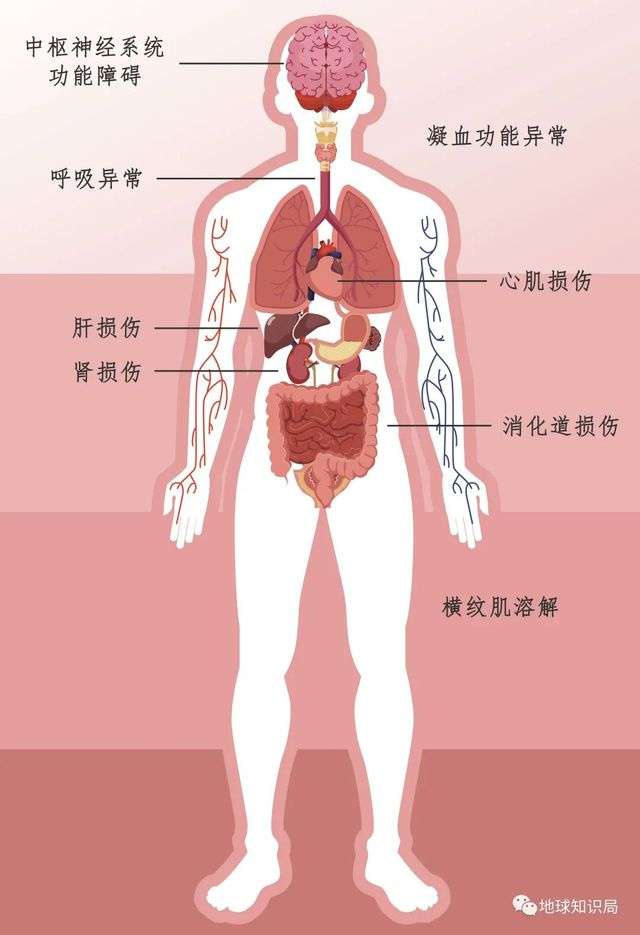 熱射病可能造成多器官受損